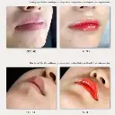 D_NQ_NP_791579-MLB47145496584_082021-O-pigmentos-labios-bblips-semi-permanente-labial-coreano-lips.webp