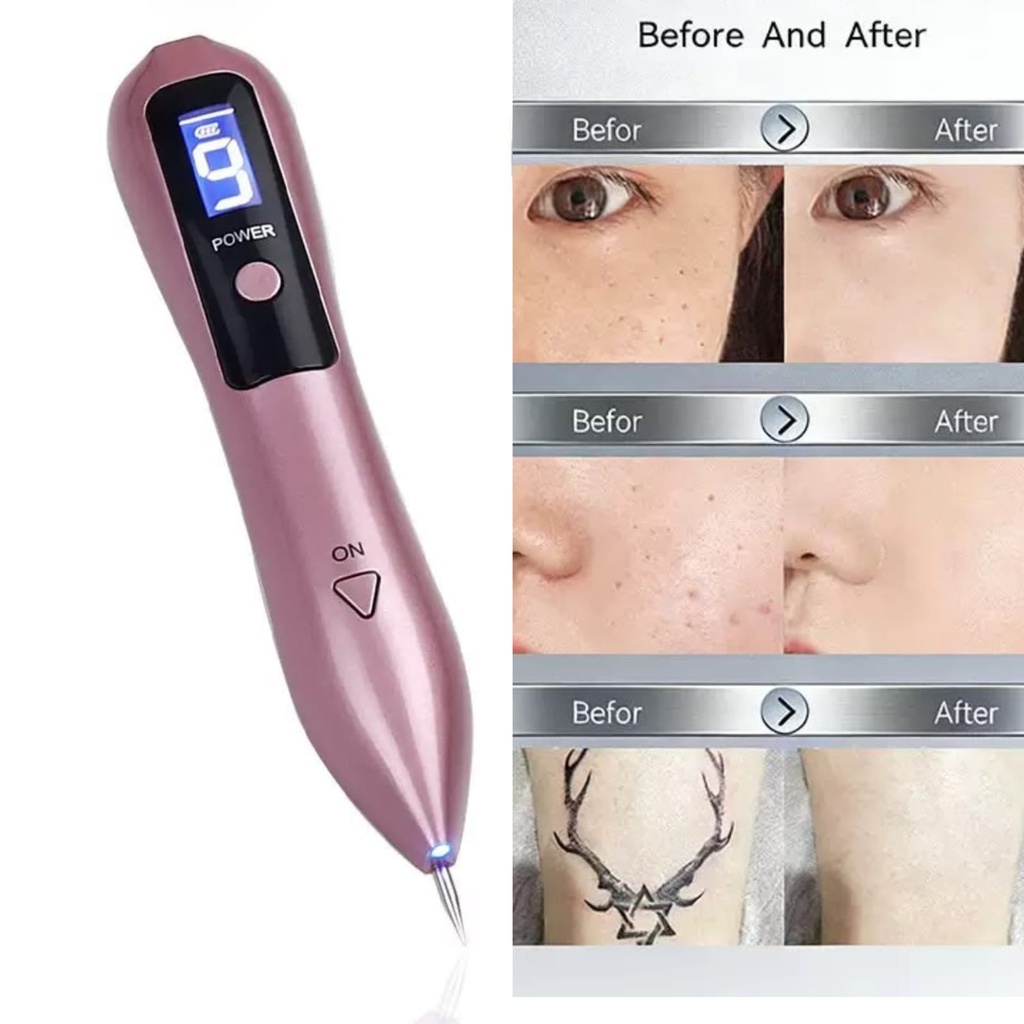 PLASMA PEN X1U.